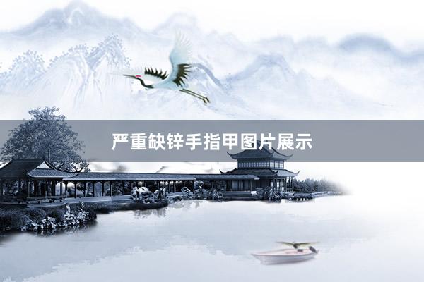 严重缺锌手指甲图片展示